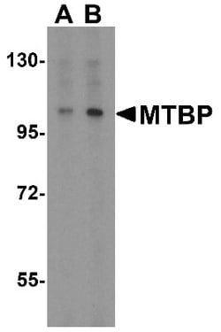MTBP Antibody, Novus Biologicals 0.025 mg | Buy Online | Novus Biologicals | Fisher Scientific
